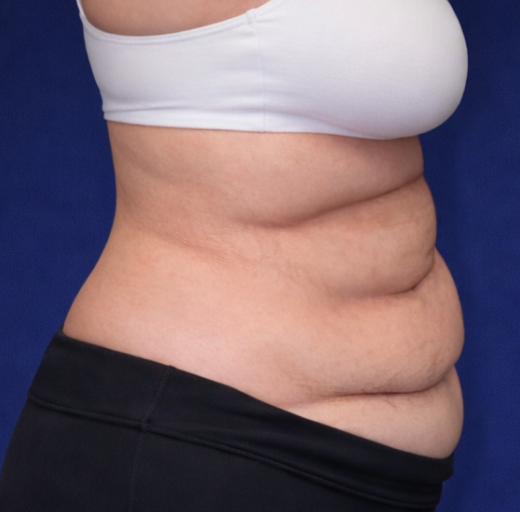 Before/After Image
